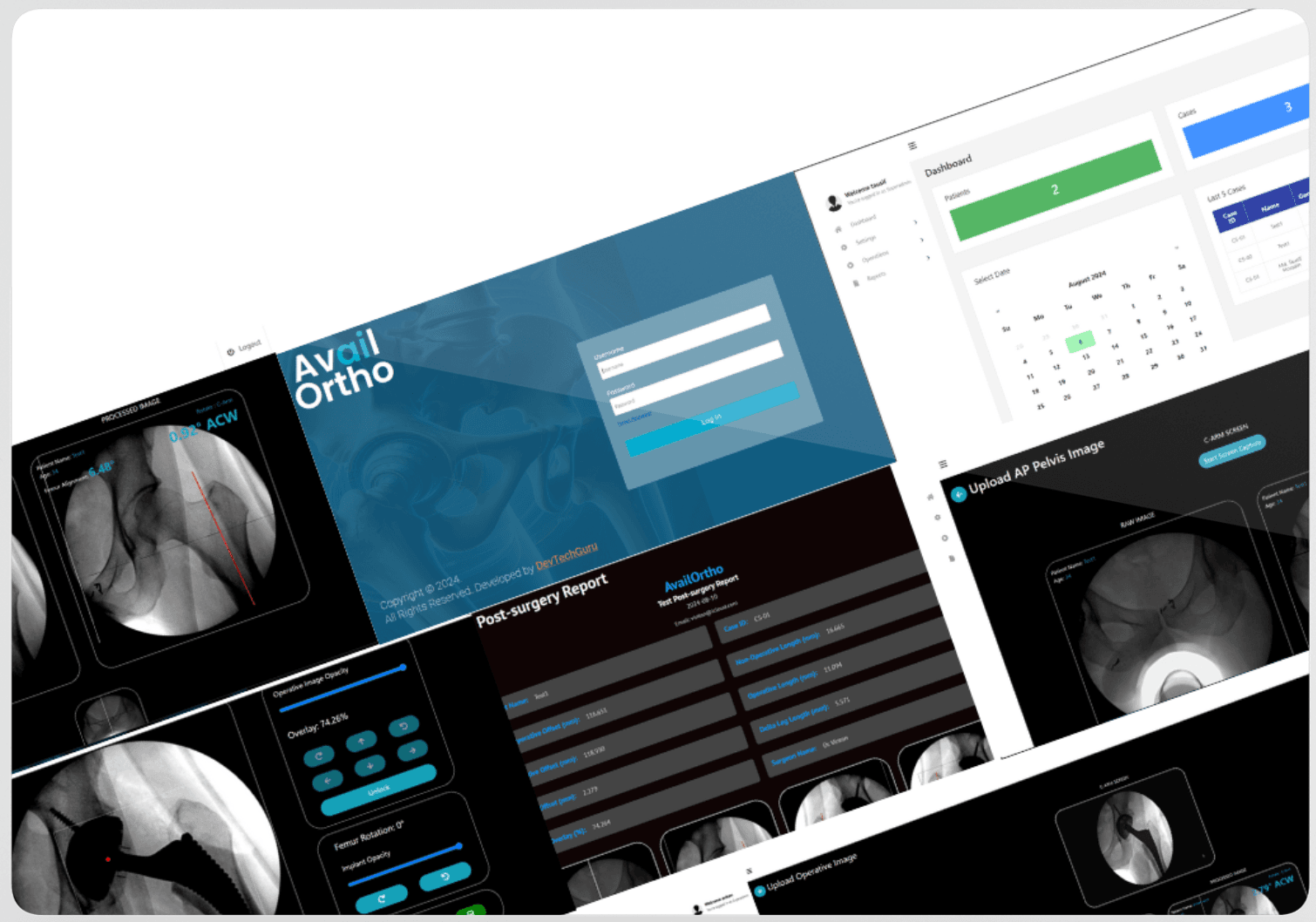 Intelligent Implant Support System